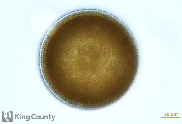 Photo of Coscinodiscus centralis